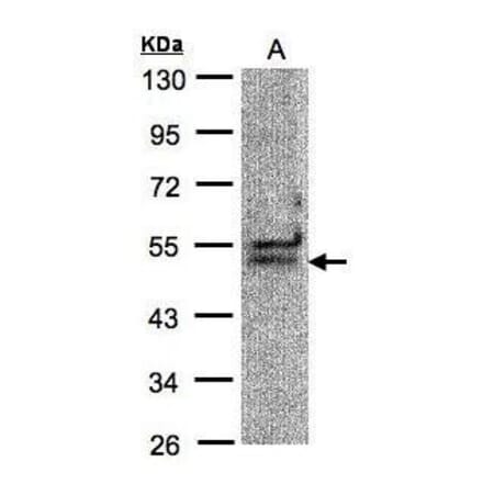 UAP56 Antibody from Signalway Antibody (35371) - Antibodies.com