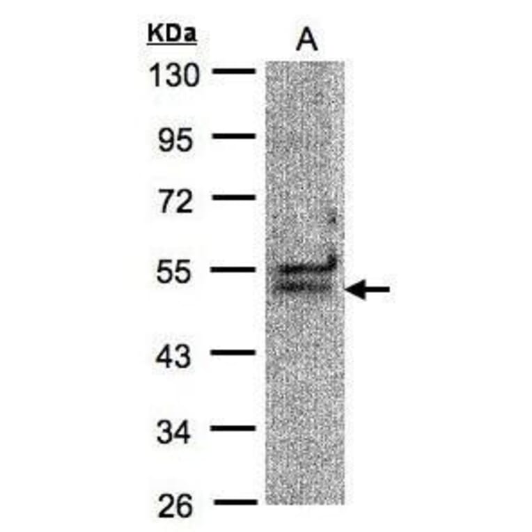 UAP56 Antibody from Signalway Antibody (35371) - Antibodies.com