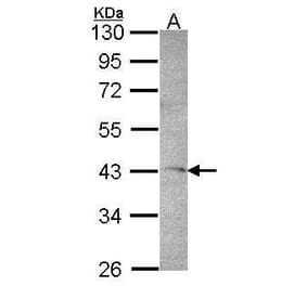 DRAK1 Antibody from Signalway Antibody (35391) - Antibodies.com