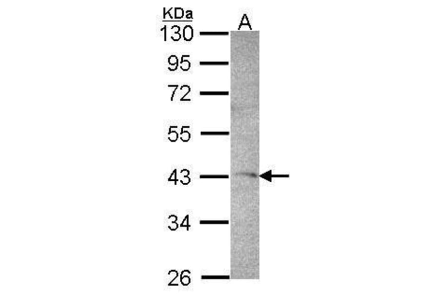 DRAK1 Antibody from Signalway Antibody (35391) - Antibodies.com