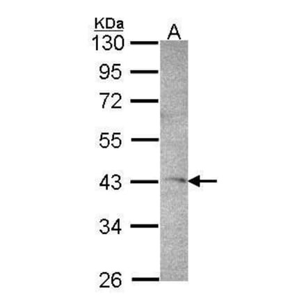 DRAK1 Antibody from Signalway Antibody (35391) - Antibodies.com