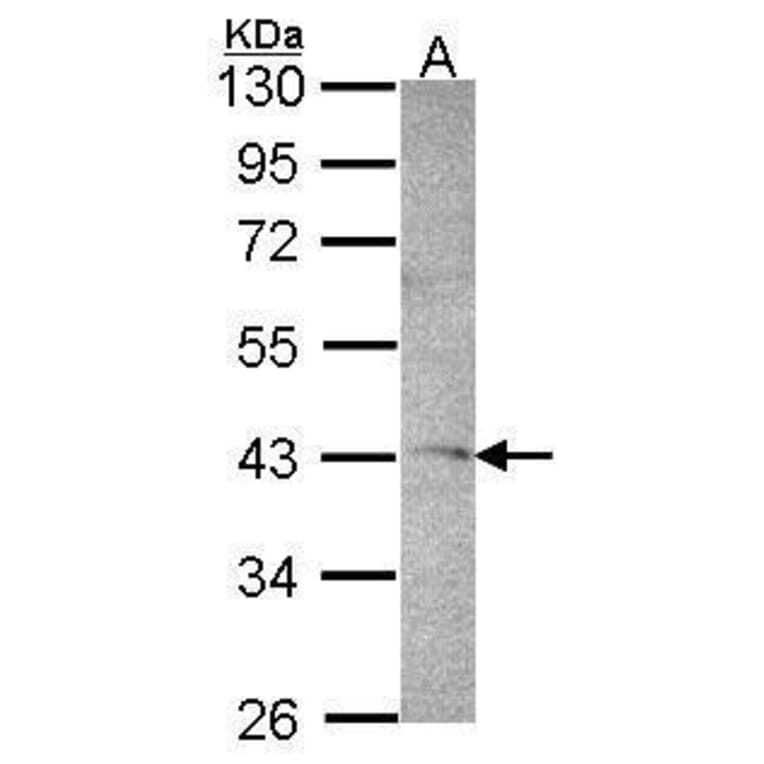 DRAK1 Antibody from Signalway Antibody (35391) - Antibodies.com