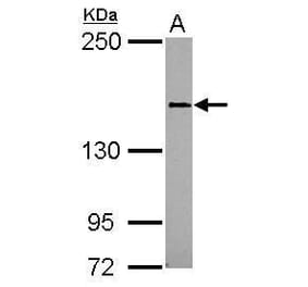 CD100 Antibody from Signalway Antibody (35396) - Antibodies.com