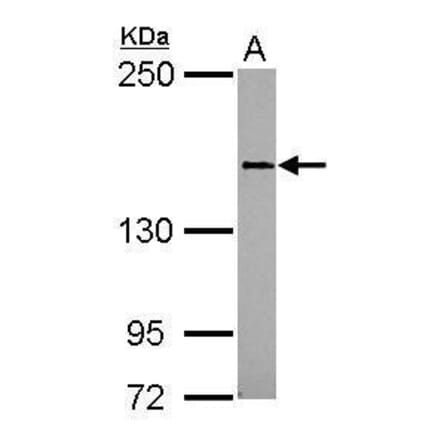CD100 Antibody from Signalway Antibody (35396) - Antibodies.com