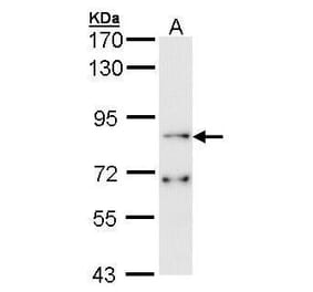 FGFR1 Antibody from Signalway Antibody (35398) - Antibodies.com
