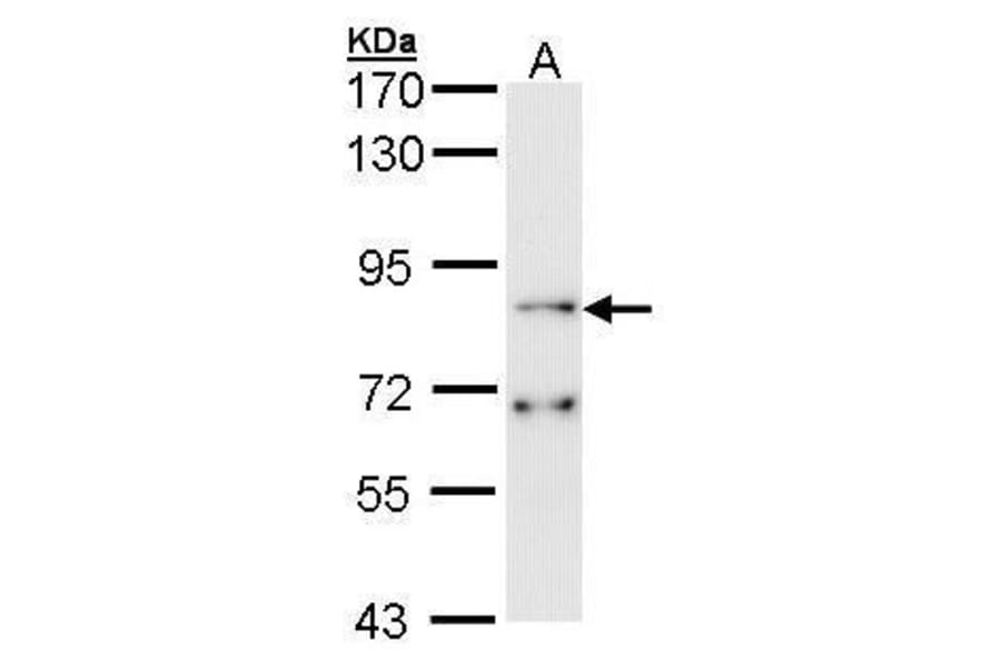FGFR1 Antibody from Signalway Antibody (35398) - Antibodies.com