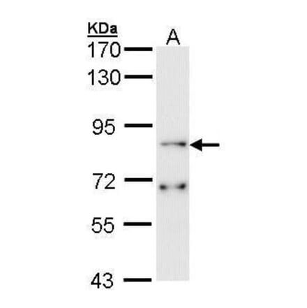 FGFR1 Antibody from Signalway Antibody (35398) - Antibodies.com