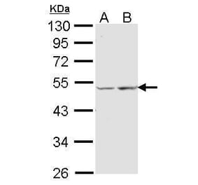 COX15 Antibody from Signalway Antibody (35403) - Antibodies.com