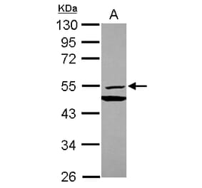 MMP10 Antibody from Signalway Antibody (35407) - Antibodies.com