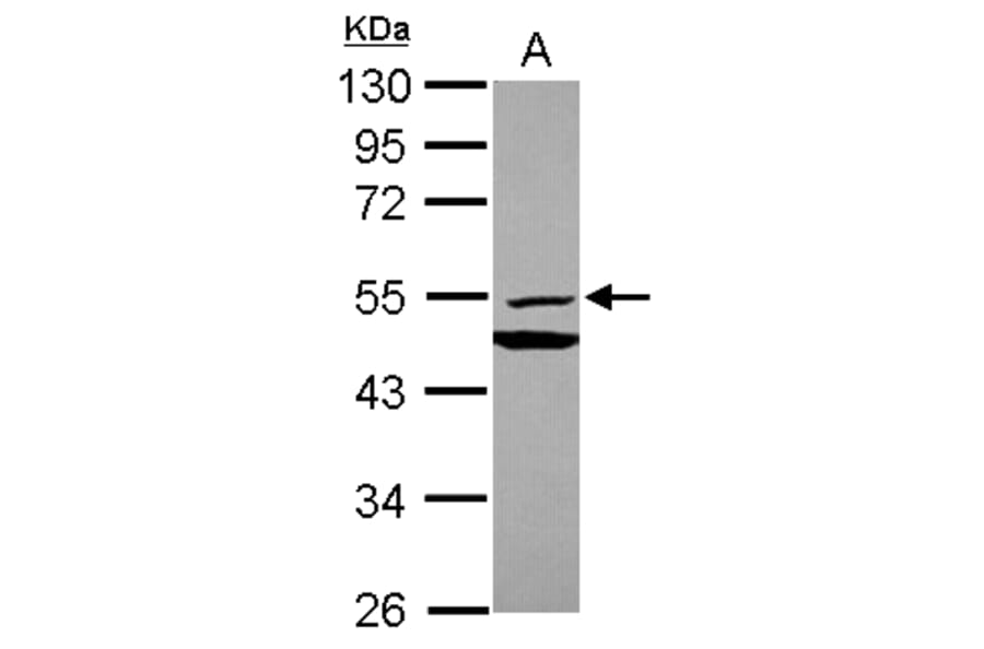 MMP10 Antibody from Signalway Antibody (35407) - Antibodies.com