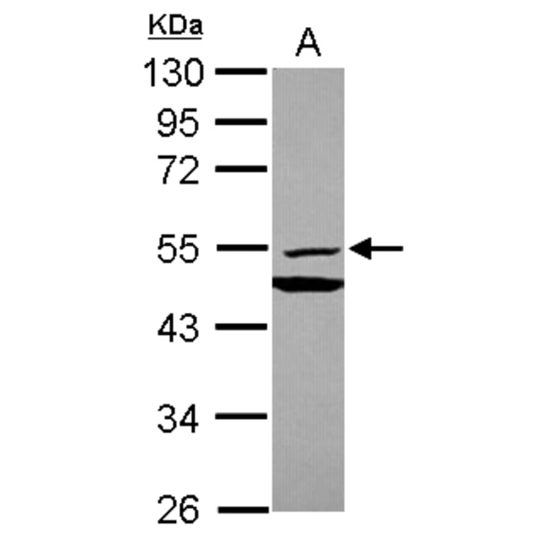 MMP10 Antibody from Signalway Antibody (35407) - Antibodies.com