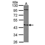MMP10 Antibody from Signalway Antibody (35407) - Antibodies.com