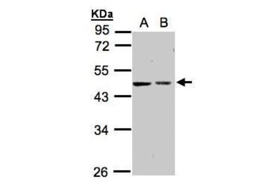 GALK2 Antibody from Signalway Antibody (35416) - Antibodies.com