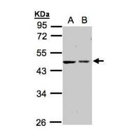 GALK2 Antibody from Signalway Antibody (35416) - Antibodies.com