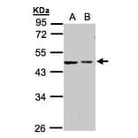 GALK2 Antibody from Signalway Antibody (35416) - Antibodies.com
