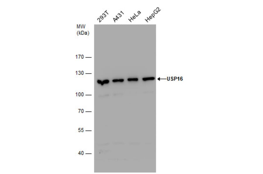 USP16 Antibody from Signalway Antibody (35418) - Antibodies.com