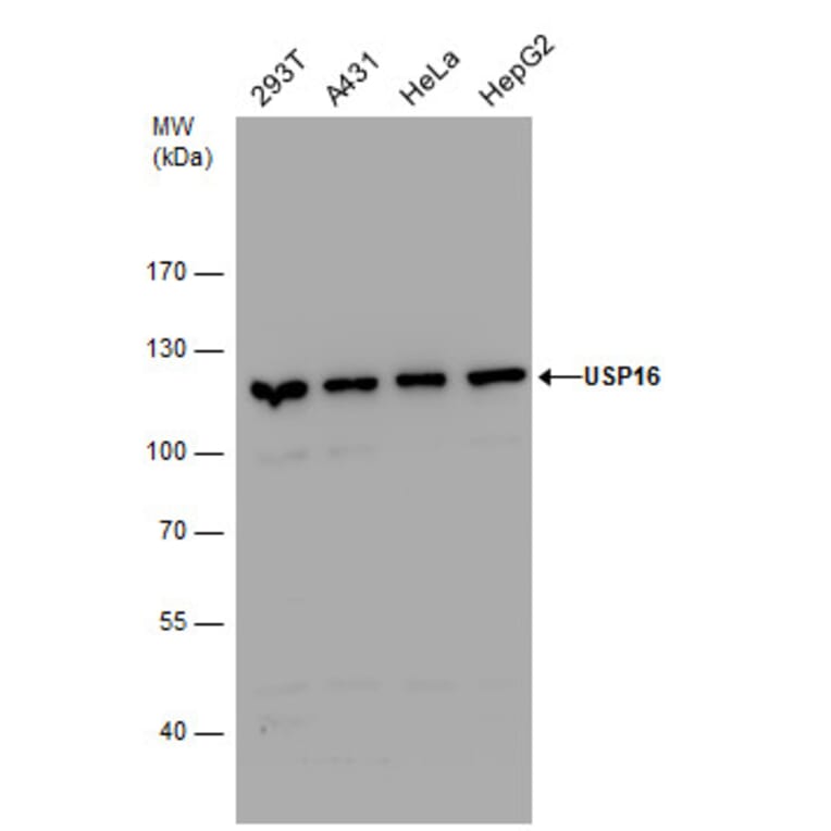 USP16 Antibody from Signalway Antibody (35418) - Antibodies.com