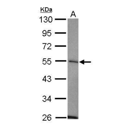 USP14 Antibody from Signalway Antibody (35419) - Antibodies.com