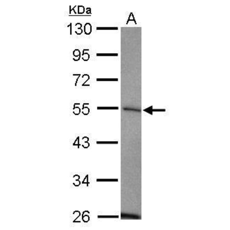 USP14 Antibody from Signalway Antibody (35419) - Antibodies.com