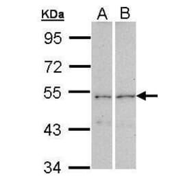 CPEB1 Antibody from Signalway Antibody (35421) - Antibodies.com