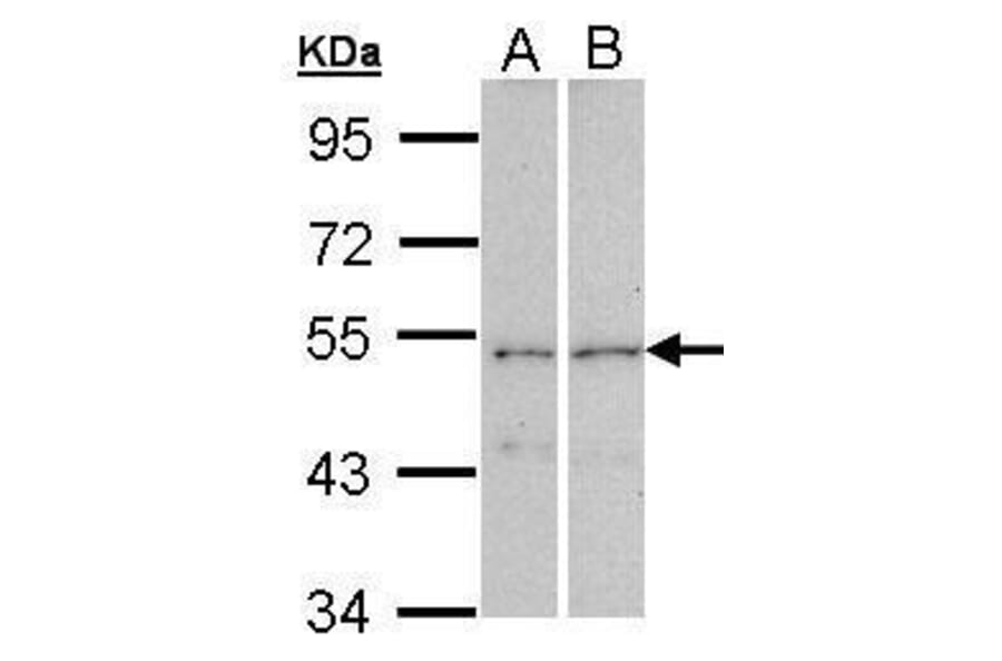 CPEB1 Antibody from Signalway Antibody (35421) - Antibodies.com