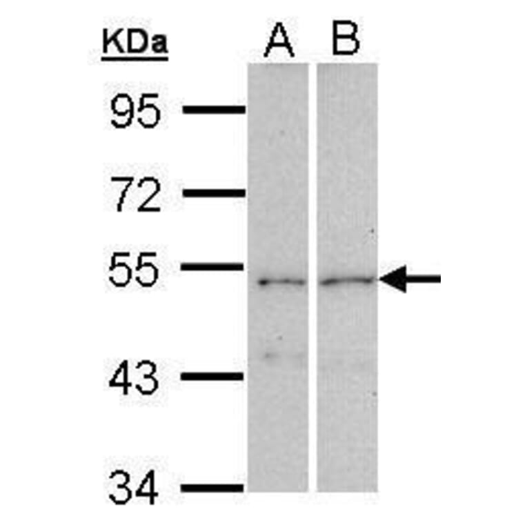 CPEB1 Antibody from Signalway Antibody (35421) - Antibodies.com