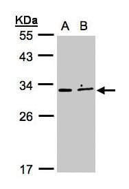Sample (30&#956;g whole cell lysate)MOLT4 B: Raji 12% SDS PAGE#35425 diluted at 1: 500