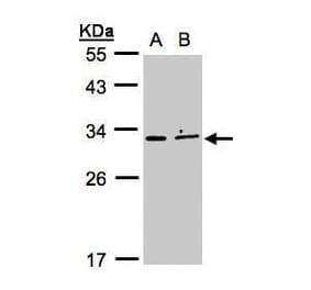 XRCC2 Antibody from Signalway Antibody (35425) - Antibodies.com