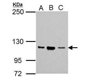 NSUN1 Antibody from Signalway Antibody (35431) - Antibodies.com