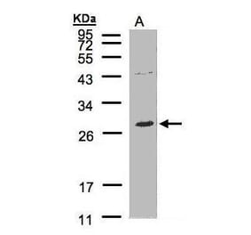 NTAL Antibody from Signalway Antibody (35437) - Antibodies.com