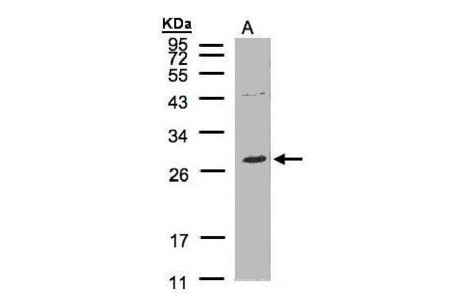 NTAL Antibody from Signalway Antibody (35437) - Antibodies.com
