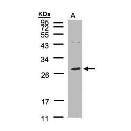 NTAL Antibody from Signalway Antibody (35437) - Antibodies.com