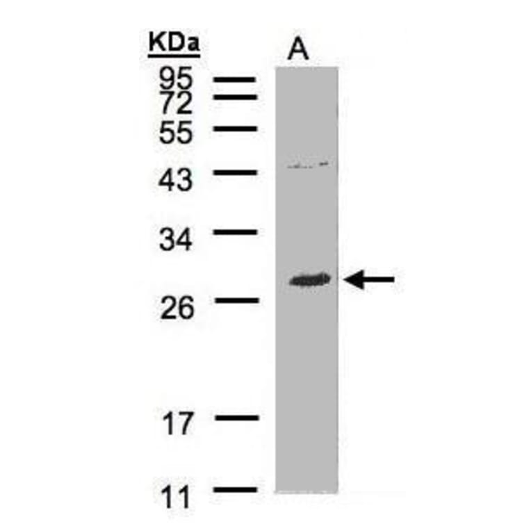 NTAL Antibody from Signalway Antibody (35437) - Antibodies.com