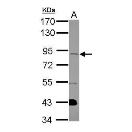 FGFR1 Antibody from Signalway Antibody (35443) - Antibodies.com