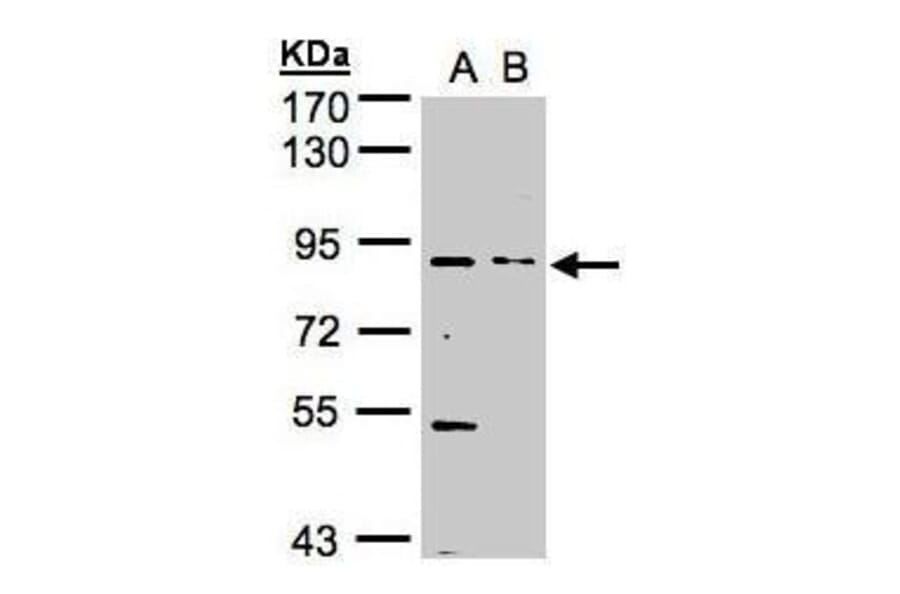 FGFR1 Antibody from Signalway Antibody (35445) - Antibodies.com