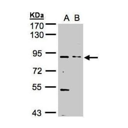 FGFR1 Antibody from Signalway Antibody (35445) - Antibodies.com