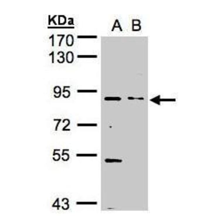 FGFR1 Antibody from Signalway Antibody (35445) - Antibodies.com