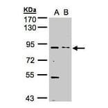FGFR1 Antibody from Signalway Antibody (35445) - Antibodies.com