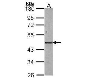 DRAK1 Antibody from Signalway Antibody (35453) - Antibodies.com