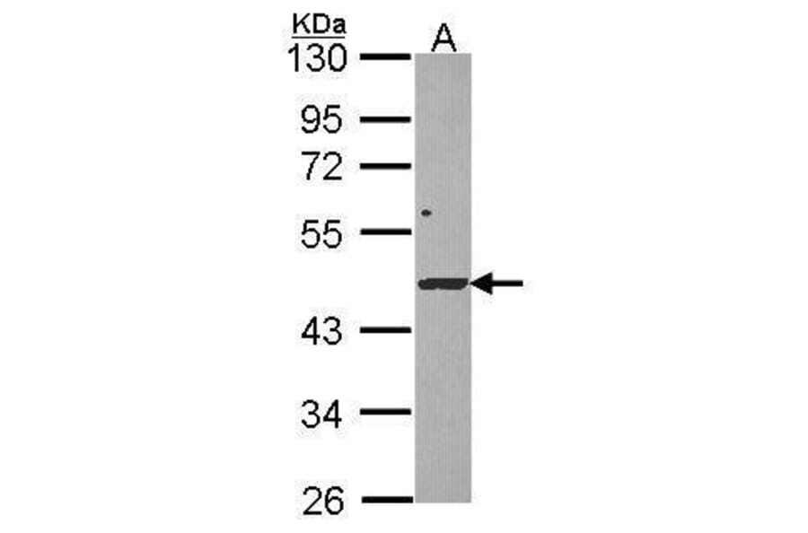DRAK1 Antibody from Signalway Antibody (35453) - Antibodies.com