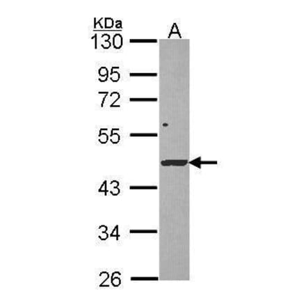 DRAK1 Antibody from Signalway Antibody (35453) - Antibodies.com