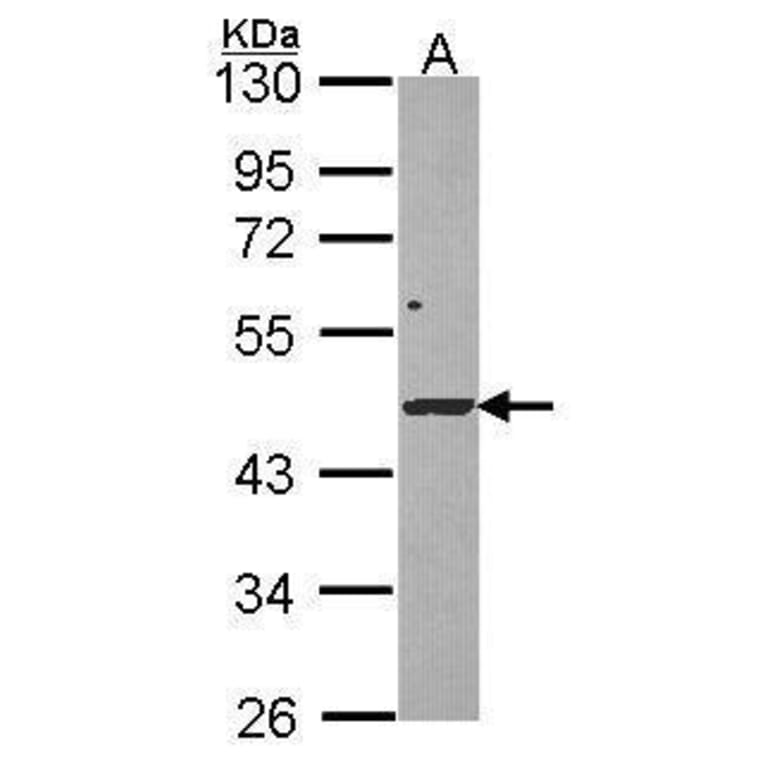 DRAK1 Antibody from Signalway Antibody (35453) - Antibodies.com