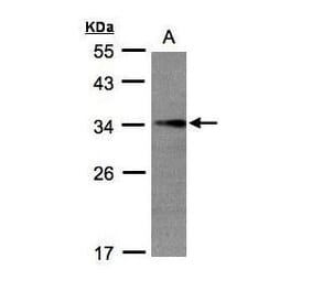 EFHD2 Antibody from Signalway Antibody (35454) - Antibodies.com