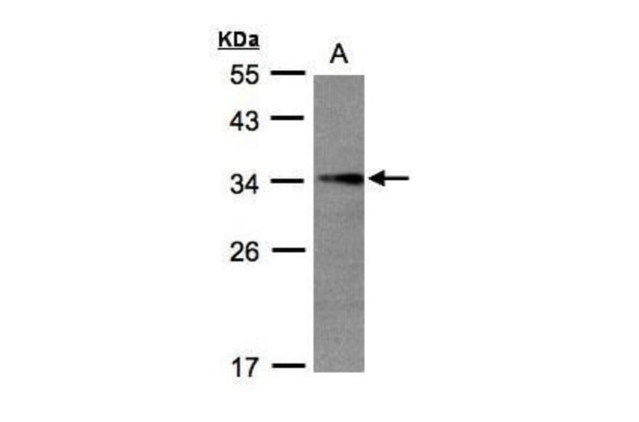 EFHD2 Antibody from Signalway Antibody (35454) - Antibodies.com