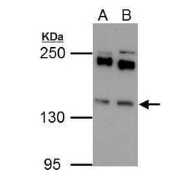 Eps15 Antibody from Signalway Antibody (35458) - Antibodies.com