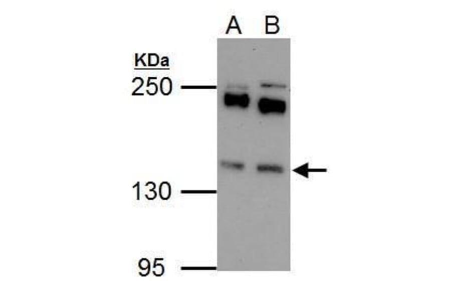 Eps15 Antibody from Signalway Antibody (35458) - Antibodies.com