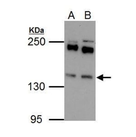 Eps15 Antibody from Signalway Antibody (35458) - Antibodies.com