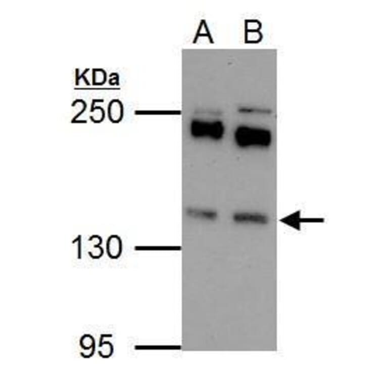 Eps15 Antibody from Signalway Antibody (35458) - Antibodies.com