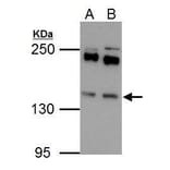 Eps15 Antibody from Signalway Antibody (35458) - Antibodies.com