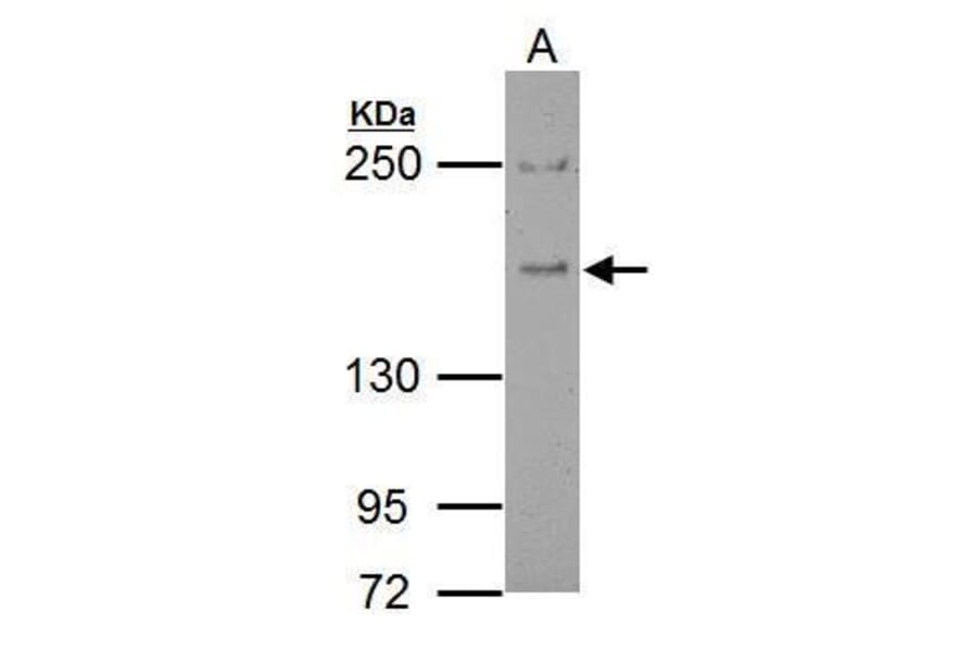 Eps15 Antibody from Signalway Antibody (35458) - Antibodies.com